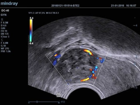 Аппарат ультразвуковой диагностический DC-40 - 388 500 руб.