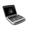 УЗИ аппарат Chison SonoTouch 80 (SonoBook 6) - 0 руб.