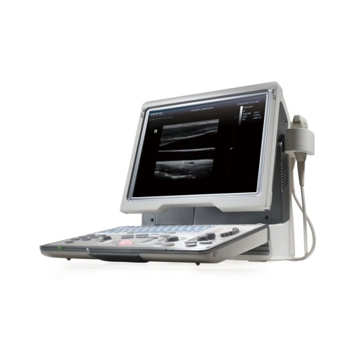 УЗИ аппарат Mindray DP-50 - 234 200 руб.